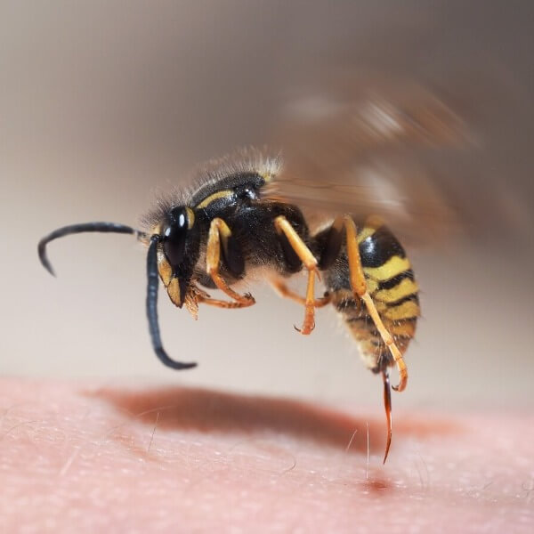 wasp sting human